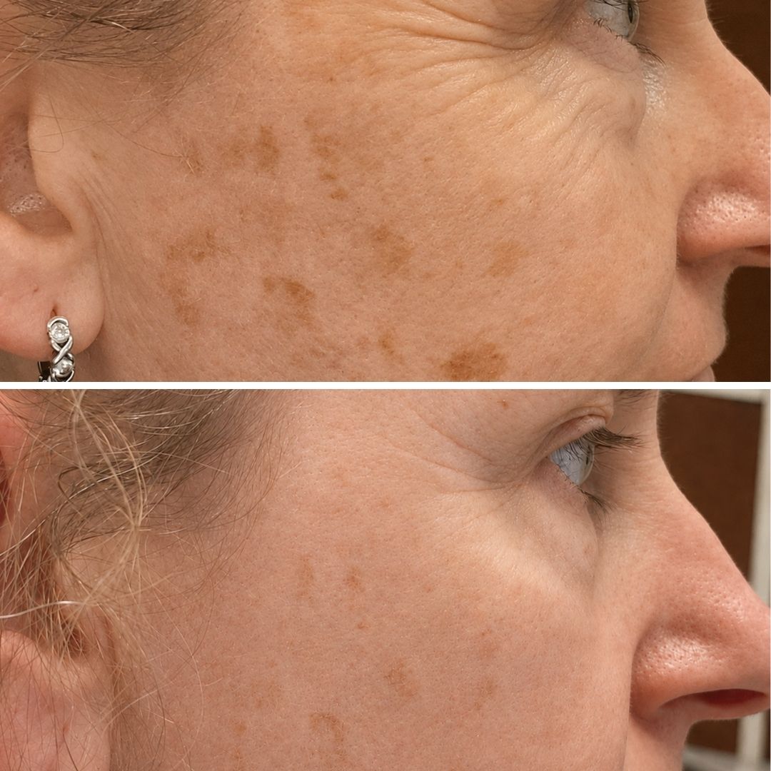 Luna Vitality: Restoring Moisture Cream