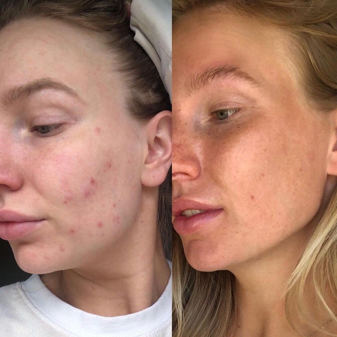 Real stories, real results: RAWKANVAS skincare transformations - RAWKANVAS